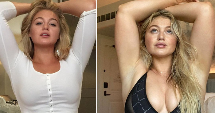 Models Proudly Share Their Pics Before & After Gaining Weight