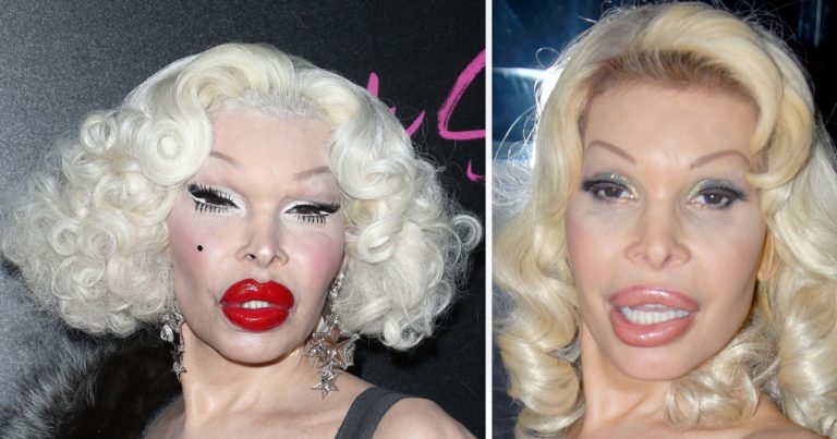 Amanda Lepore has ‘the most expensive body in the world’ – this is her net worth