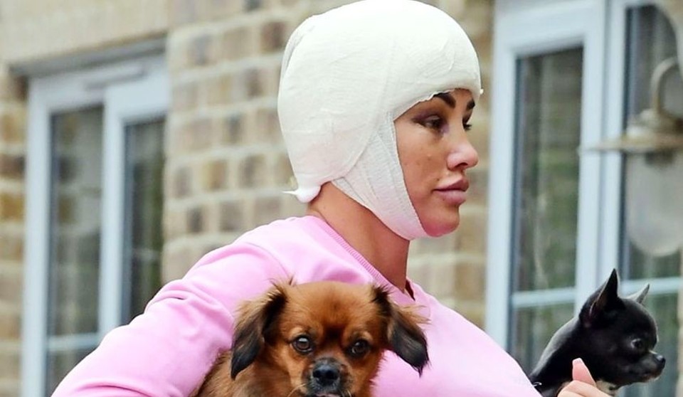 With her head bandaged and bruised eyes this is how the TV star was seen recently