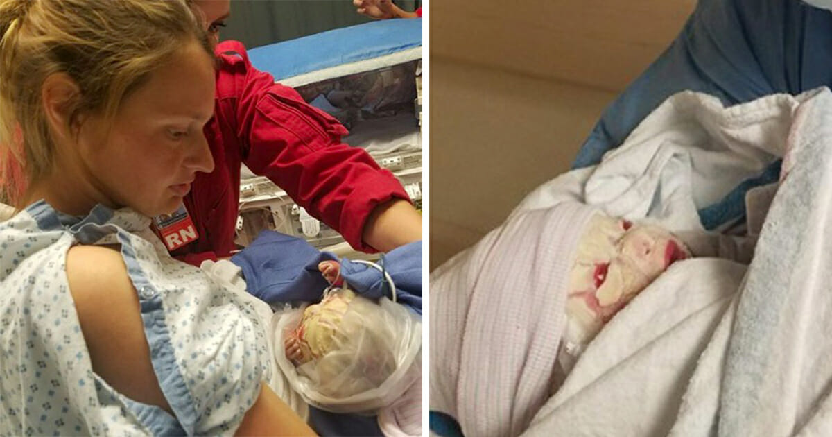 Doctors carry out an emergency C-section – then panic when baby’s face starts to change