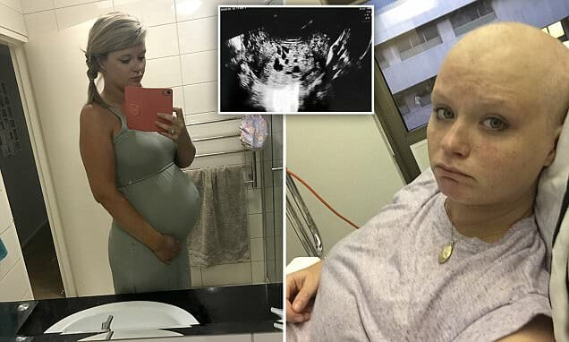 Mom of 2 thinks she’s pregnant: Instead “gives birth” to a cancer tumor that was about to kill her