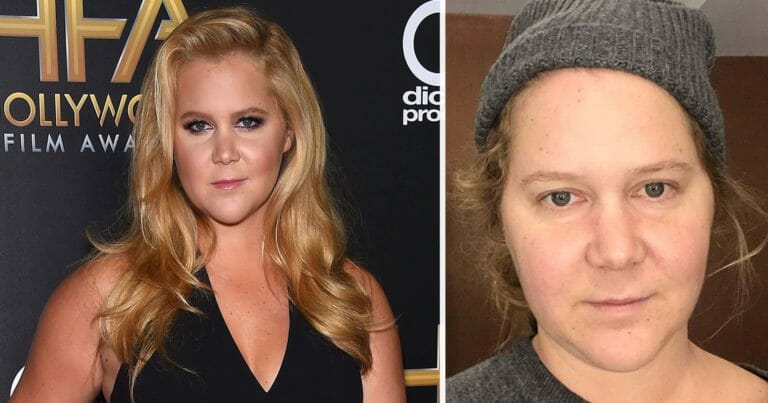 “We are all different and beautiful”: Amy Schumer posts no-makeup photos and shows off her natural beauty