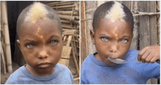 A video of a little boy with natural blue eyes, white hair, and a lightning mark on his face has gone viral.