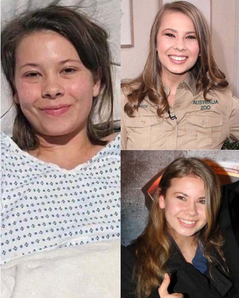 Bindi Irwin: Overcoming a Decade of Struggle