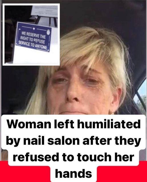 Unfair Treatment at Nail Salon: A Story of Lupus and Discrimination