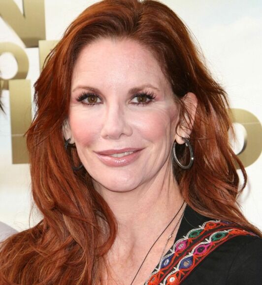 Embracing Age with Confidence: Melissa Gilbert’s Journey without Botox and Implants