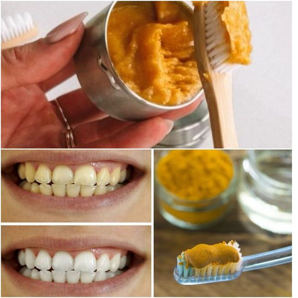 Discover the Natural Wonder of Turmeric for Dental Health